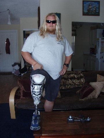 Chuck "Big Daddy" Meier showing off his original "Viking Leg" 